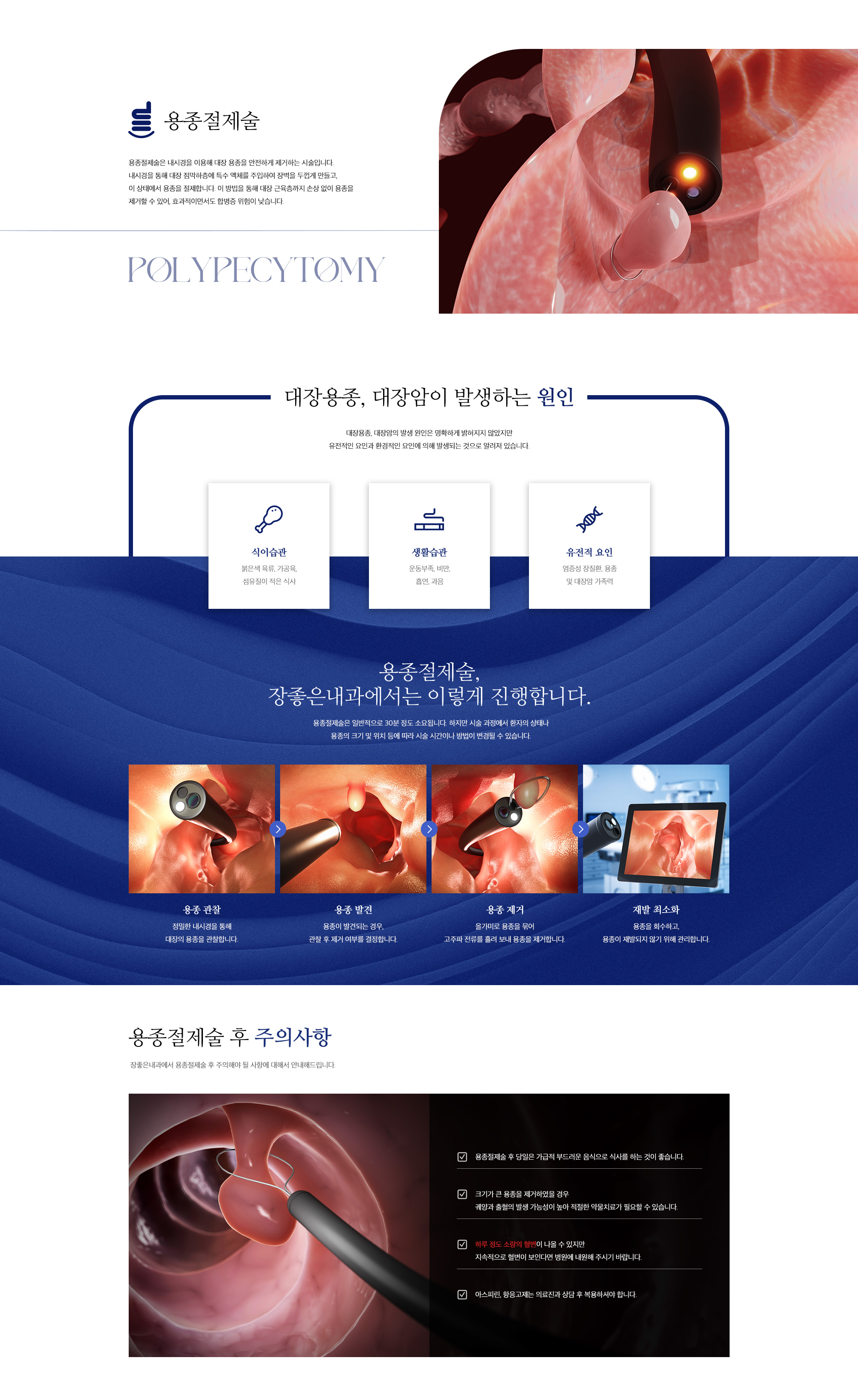 용종제거 등 각종 치료내시경